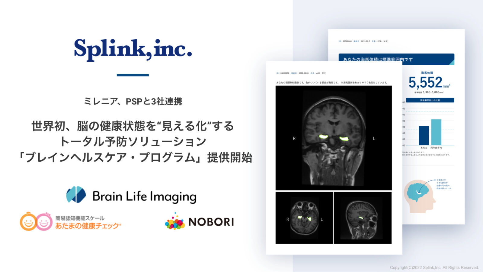 Splink、ミレニアとPSPと3社連携。世界初、脳の健康状態を“見える化”するトータル予防ソリューション「ブレインヘルスケア・プログラム(TM)」を提供開始