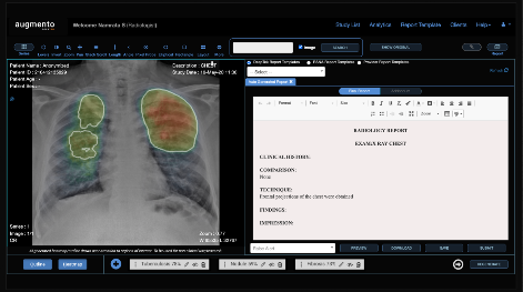 NTTデータグループのクニエ、チュニジアでのAI画像診断支援の実証実験を米DeepTek社と共に開始